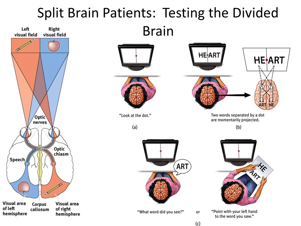 Split brain. Split Brain problem. Газзанига расщепленный мозг.