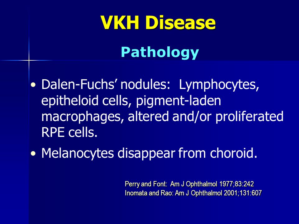 Vogt Koyanagi Harada Disease Ppt Video Online Download