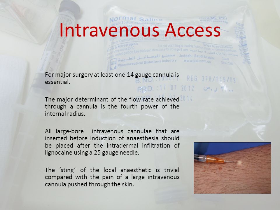 Intravenous Access The ability to obtain intravenous (IV) access is an  essential skill in medicine and is performed in a variety of settings by  paramedics, - ppt video online download