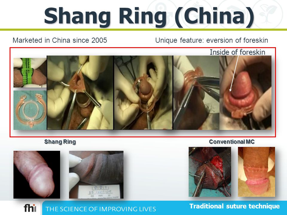 Shang Ring. 