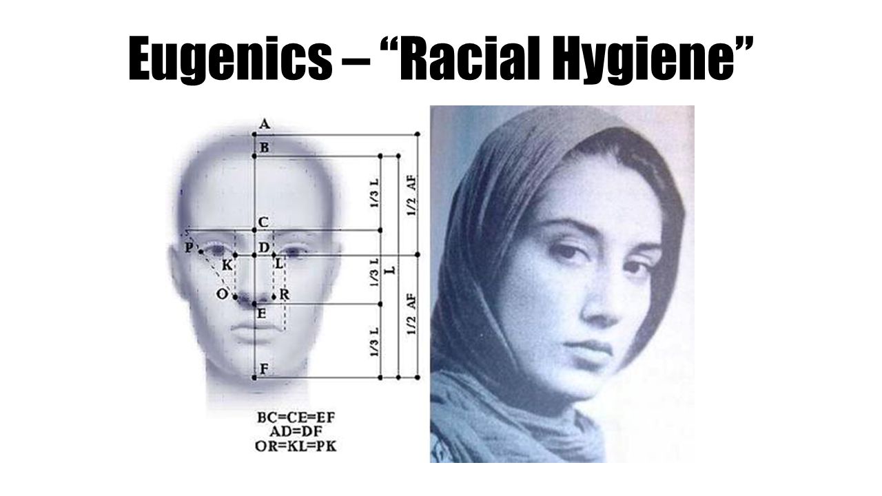 Eugenics – Racial Hygiene
