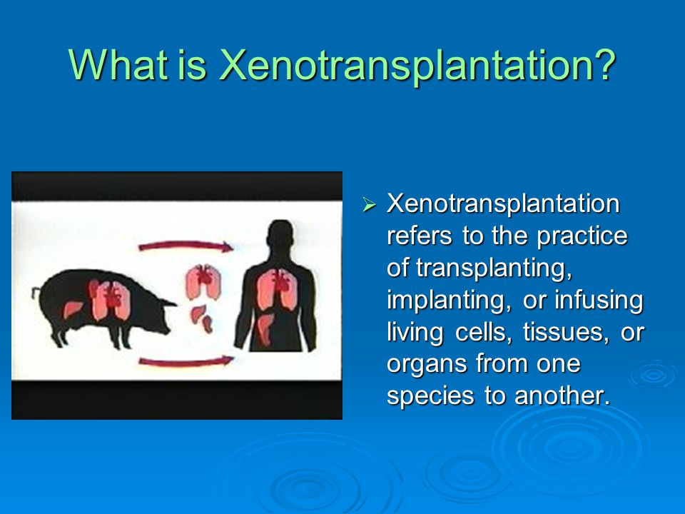 Xenotransplantation Pigs and Humans What is xenotransplantation? - ppt  download