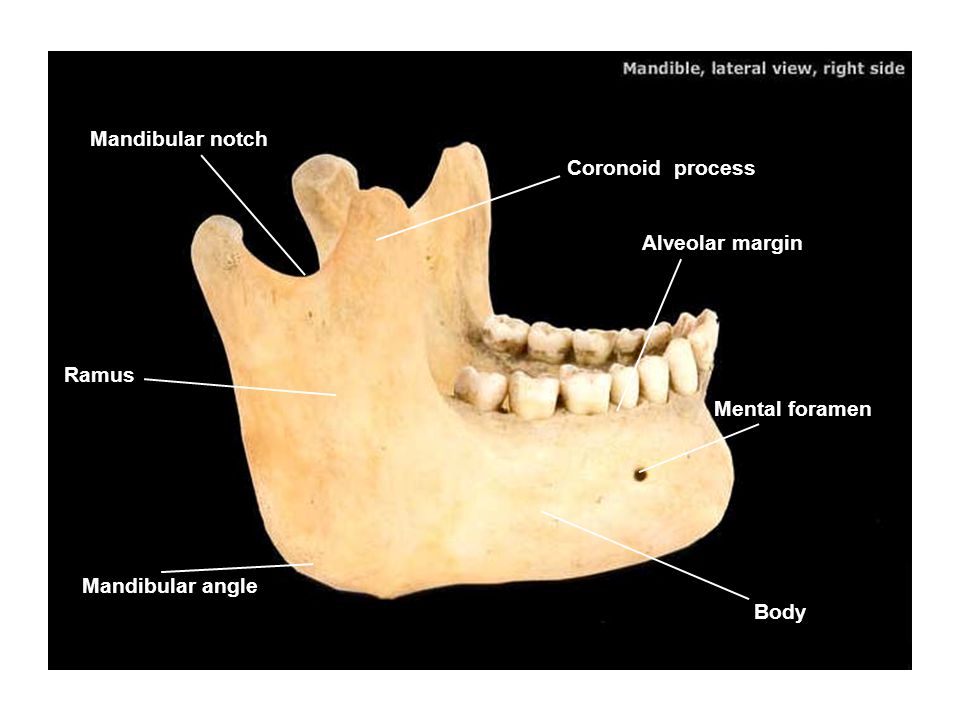 Frontal Bone Nasal Bone Glabella Lacrimal Bone Supraorbital Notch Ppt Video Online Download