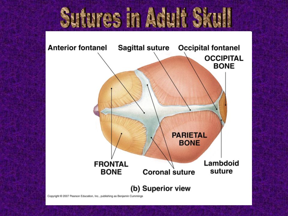 Sutures in Adult Skull