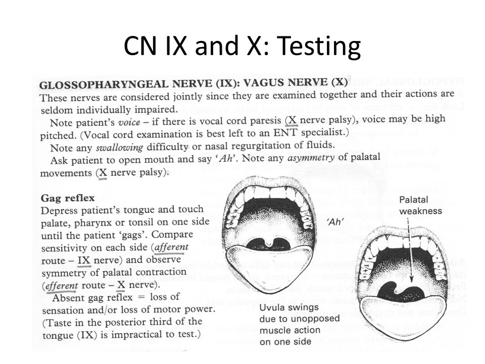 CN IX and X: Testing 