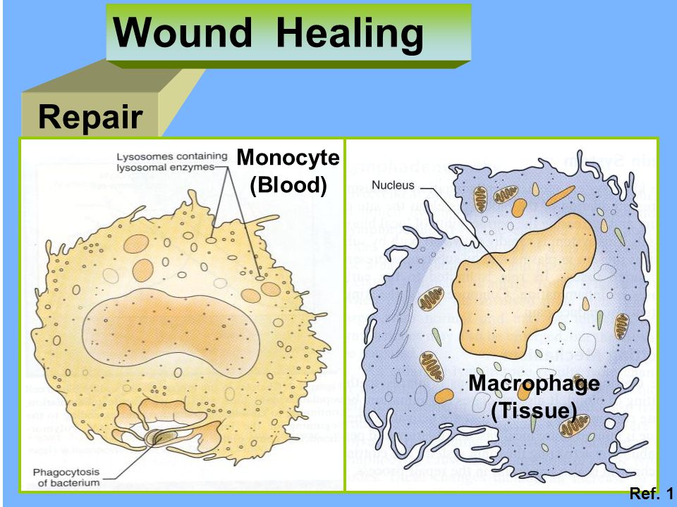 Wound Healing Repair Monocyte (Blood) Macrophage (Tissue) Ref. 1
