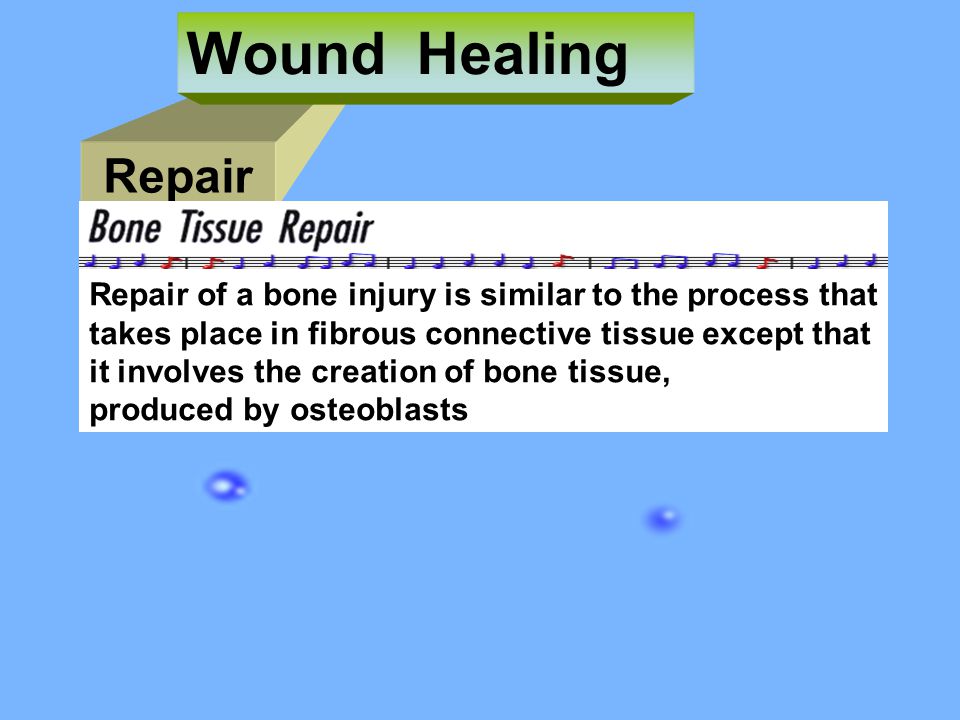 Wound Healing Repair. Repair of a bone injury is similar to the process that. takes place in fibrous connective tissue except that.