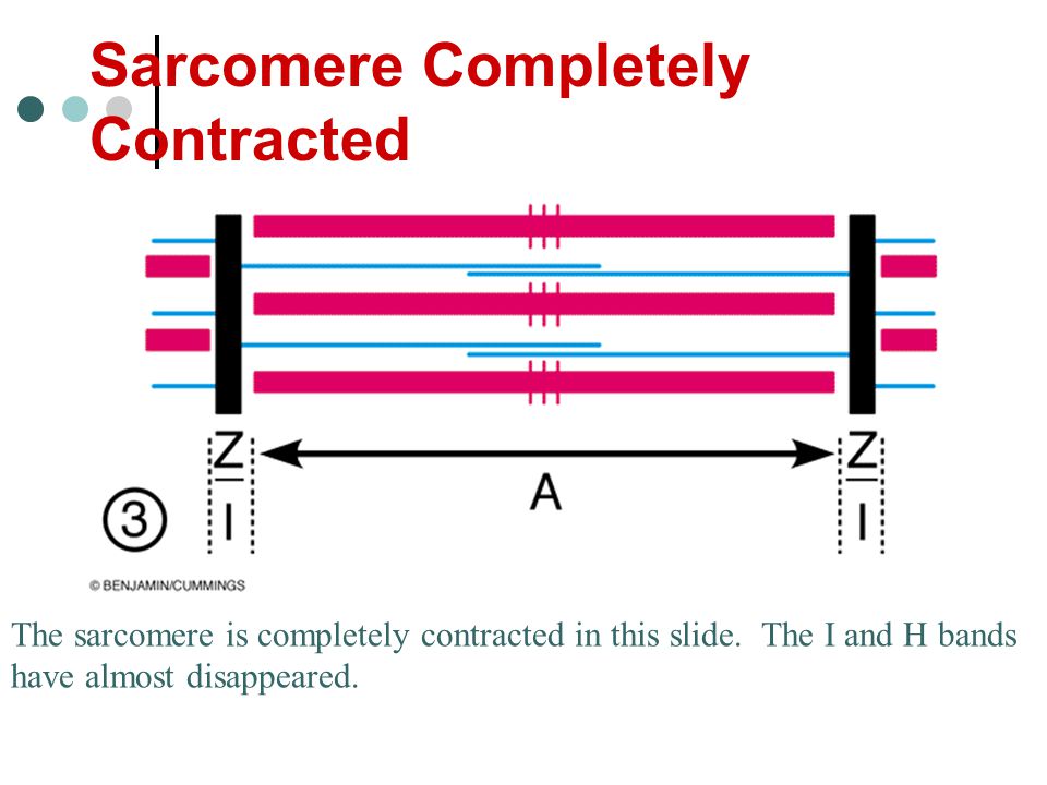 Sarcomere Completely Contracted.