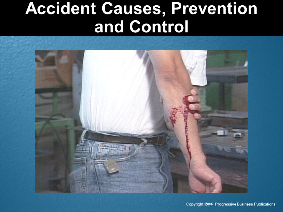 Accident Causes, Prevention and Control