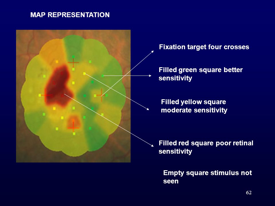 MAP REPRESENTATION Fixation target four crosses. Filled green square better sensitivity. Filled yellow square moderate sensitivity.