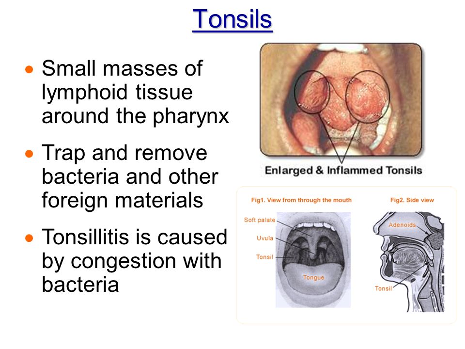 Tonsils Small masses of lymphoid tissue around the pharynx