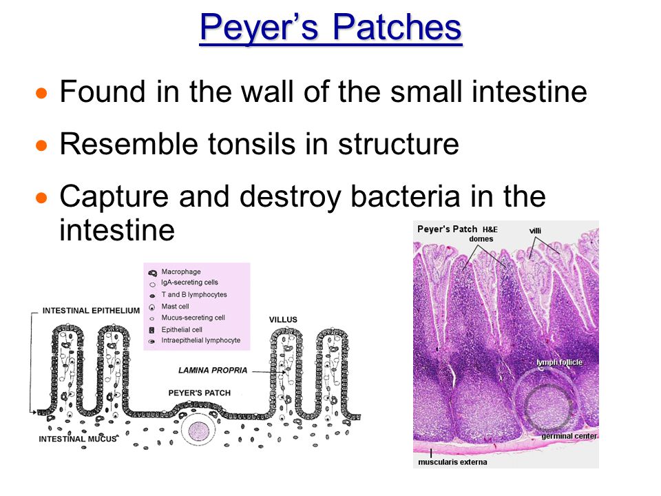 Peyer’s Patches Found in the wall of the small intestine