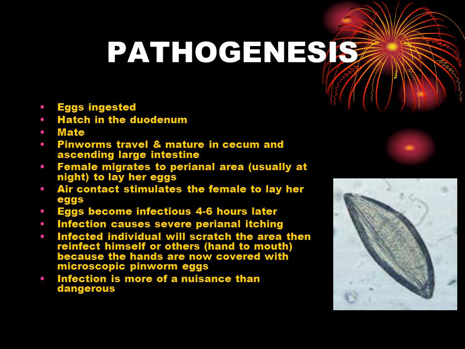 pinworm patogenezis távolítsa el az emberi parazitákat
