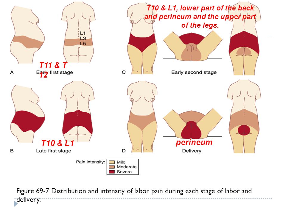 Analgesia for Labor and Vaginal Delivery - ppt download