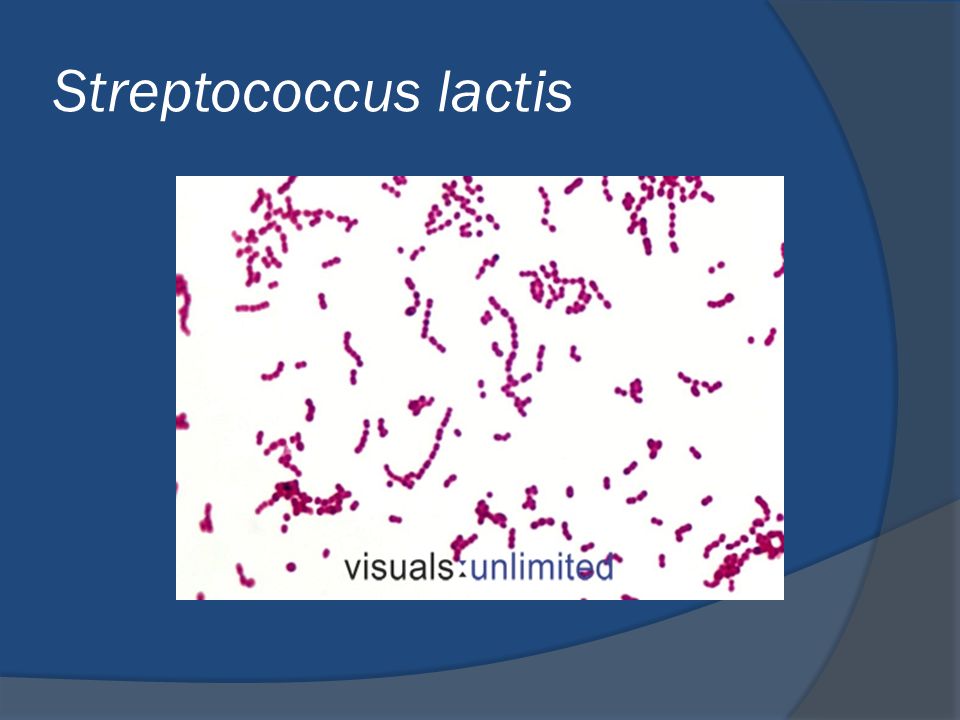 streptococcus lactis