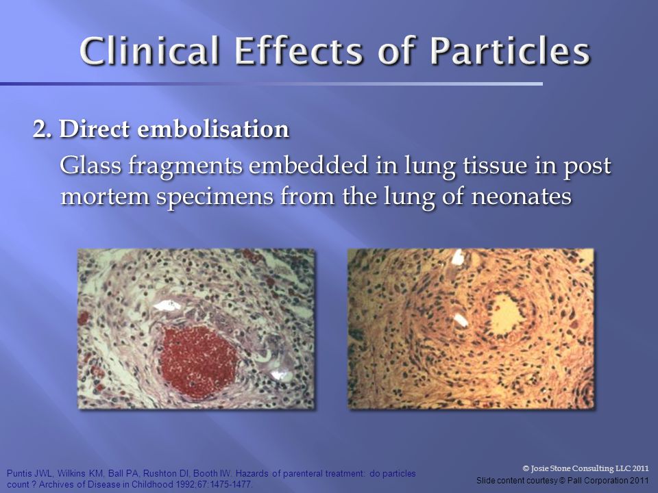 Clinical Effects of Particles