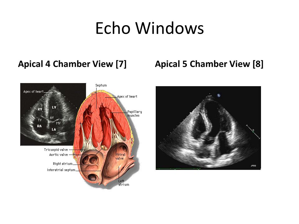 Echocardiogram Dr Emily Player. - ppt video online download