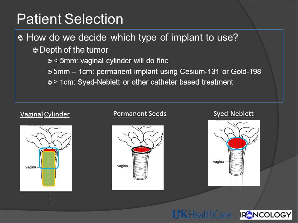 Patient Selection How do we decide which type of implant to use