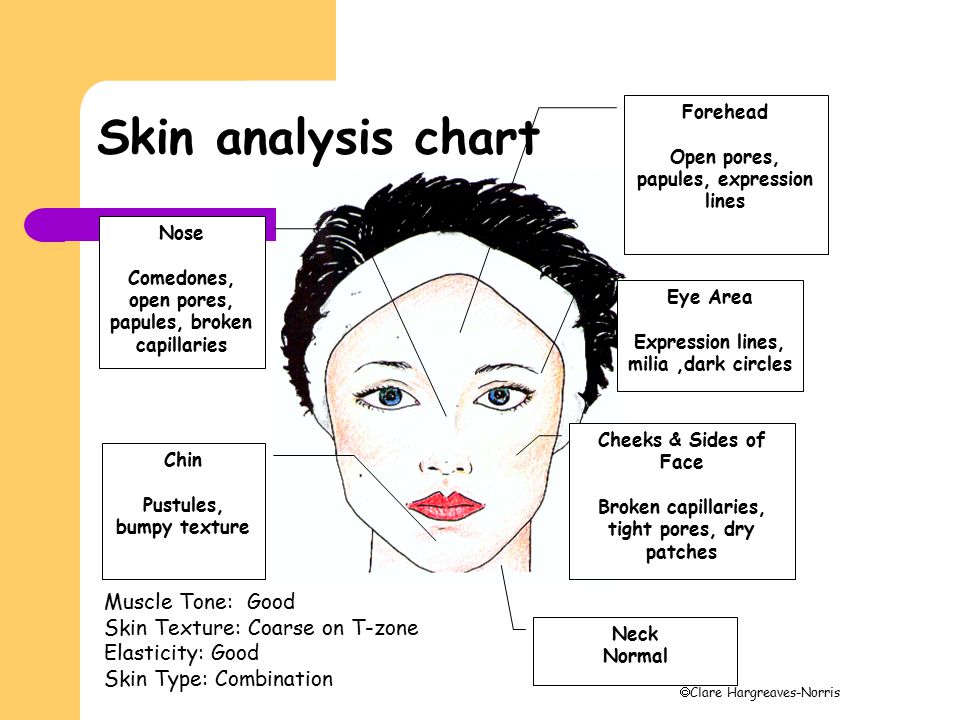 Facial Skin Analysis Chart