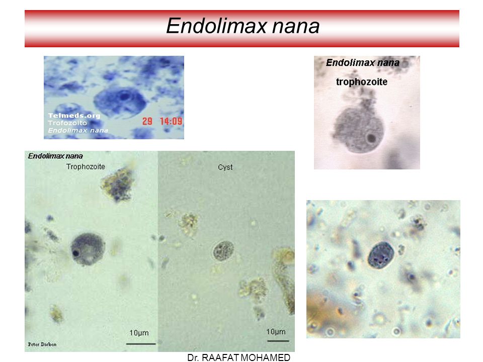 Entamoeba coli в кале. Entamoeba histolytica микроскопия. Endolimax Nana микроскопия.