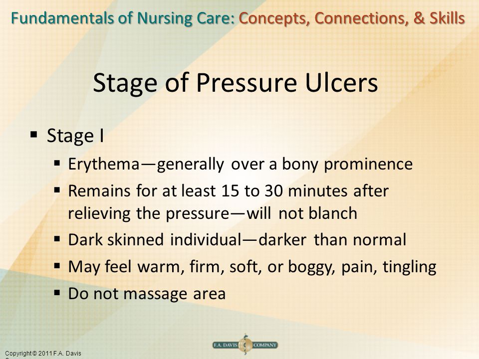 Continuing education for pressure ulcer prevention: Taking the pressure  off! (Part 3) at Interior Health | BC PSLS Blog