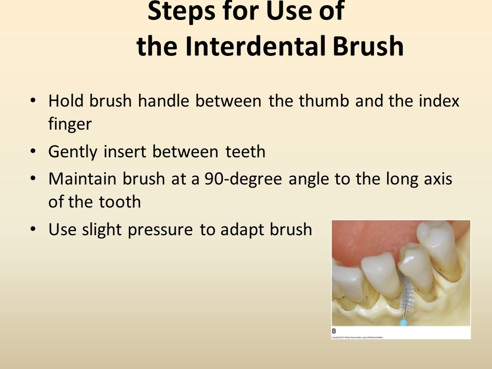 Steps for Use of the Interdental Brush