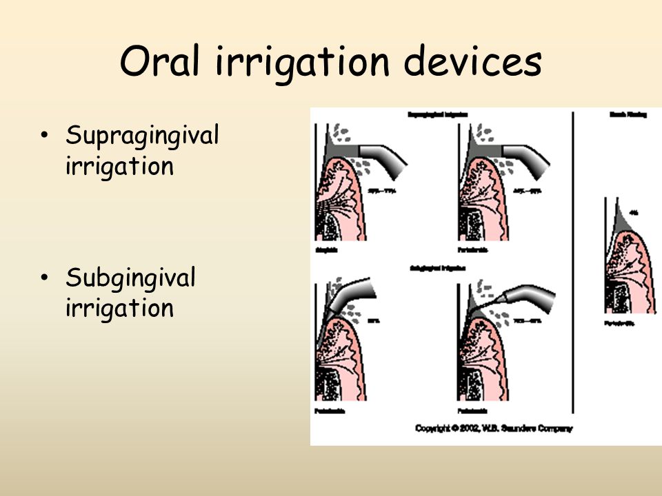 Oral irrigation devices