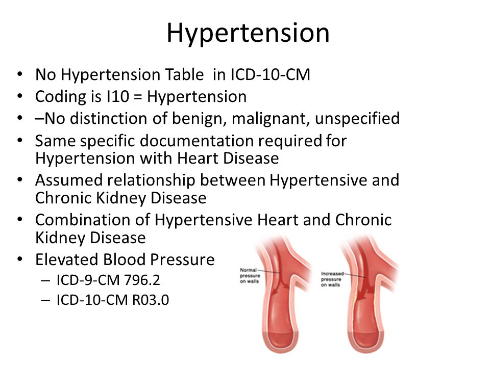 Hypertension No Hypertension Table in ICD-10-CM