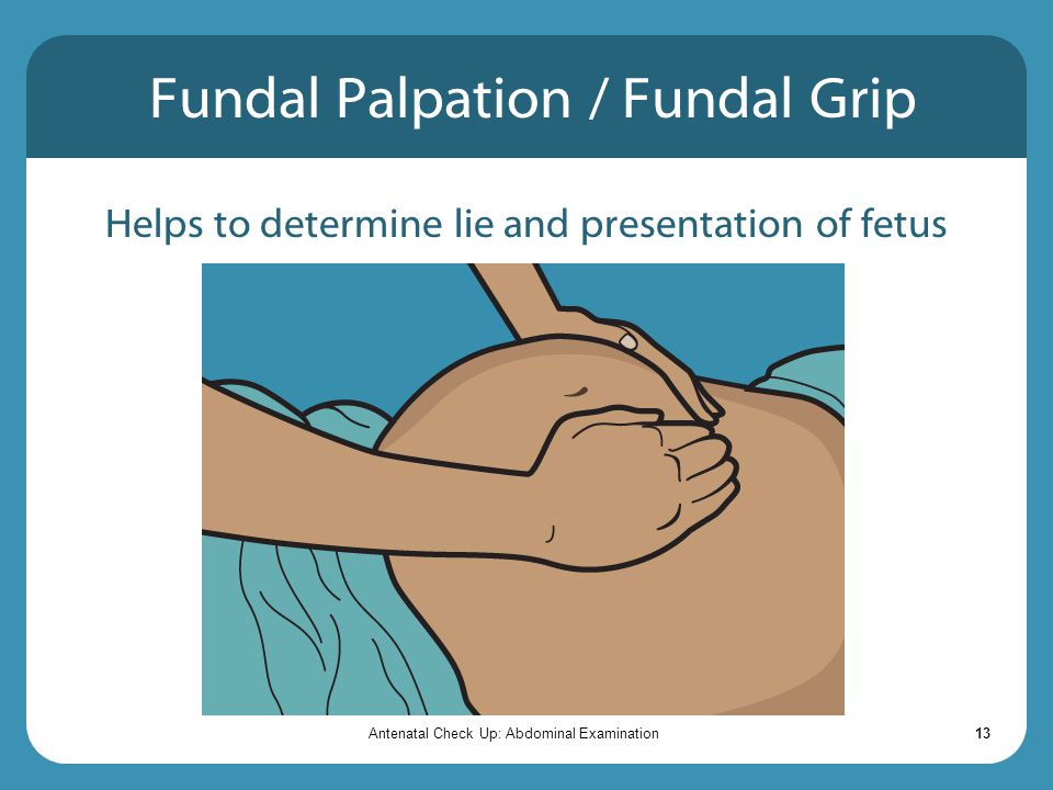 Fundal Palpation / Fundal Grip