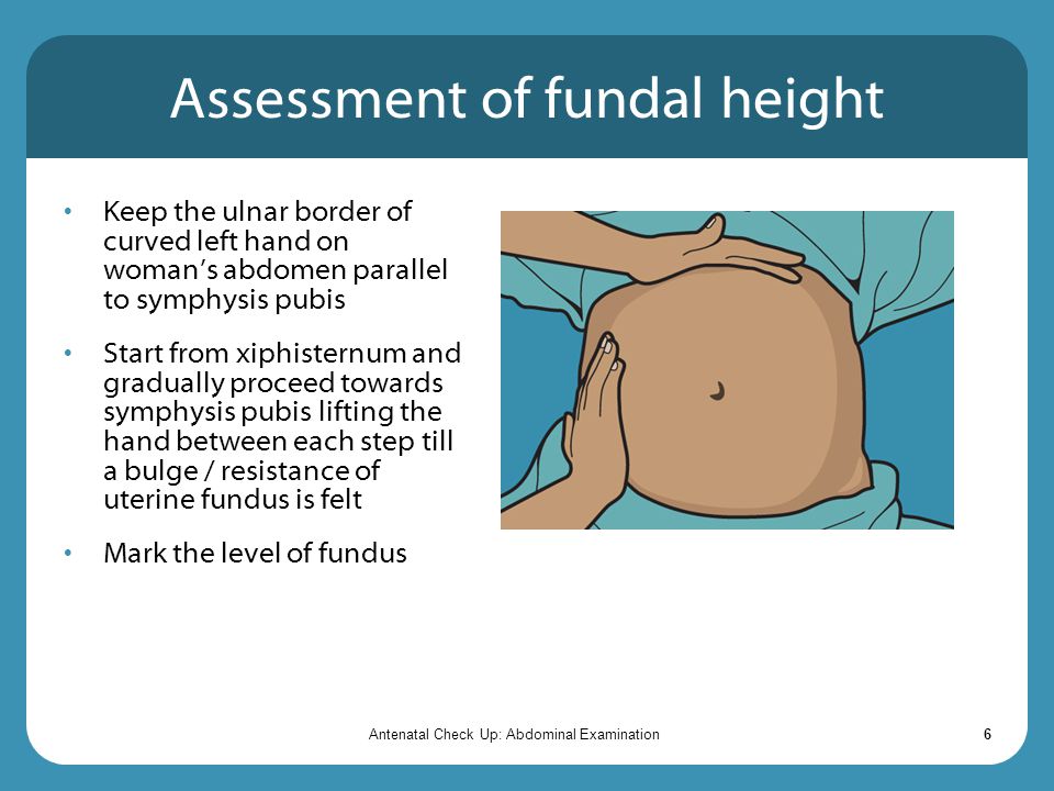 Assessment of fundal height