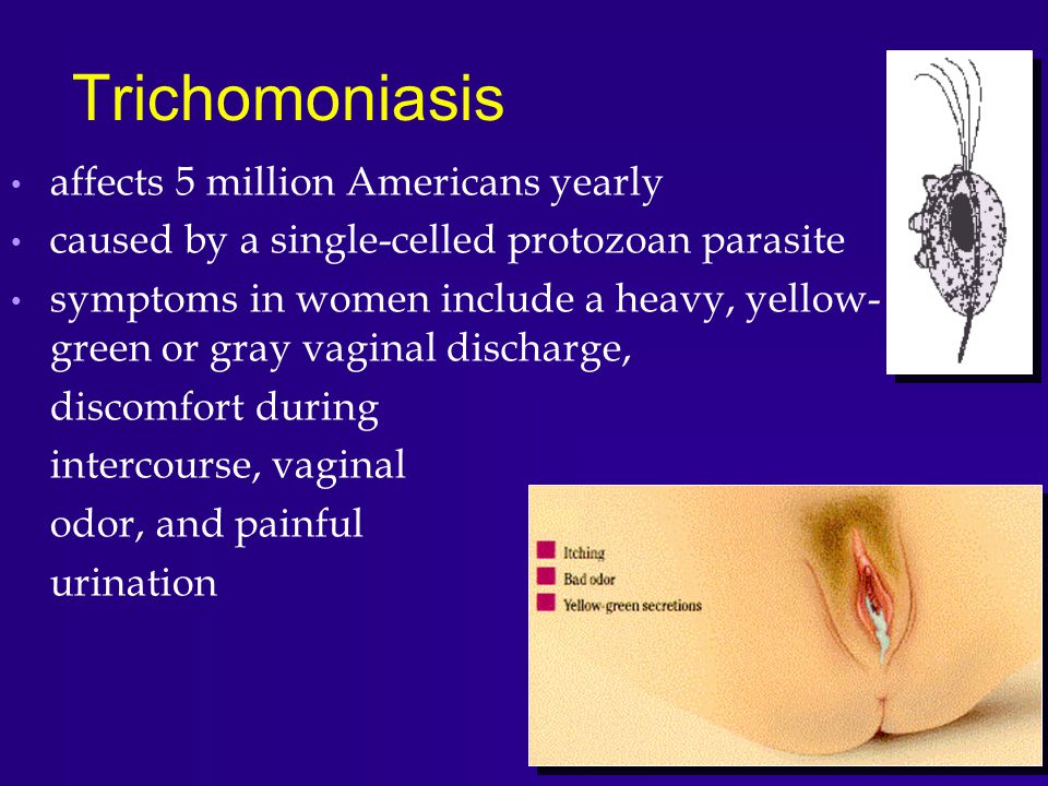 Bacterial Infections Of The Reproductive System