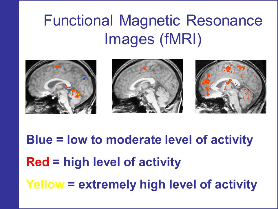 Functional Magnetic Resonance Images (fMRI)