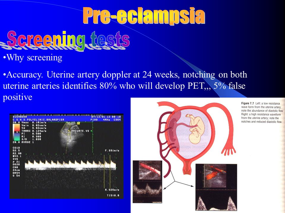Pre-eclampsia Screening tests Why screening