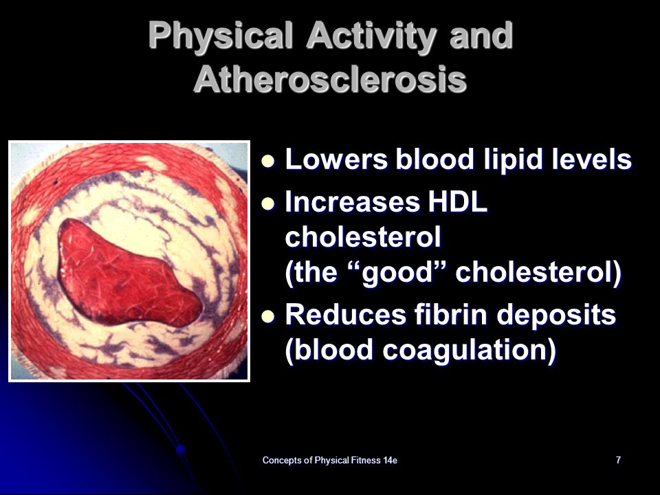 Physical Activity and Atherosclerosis