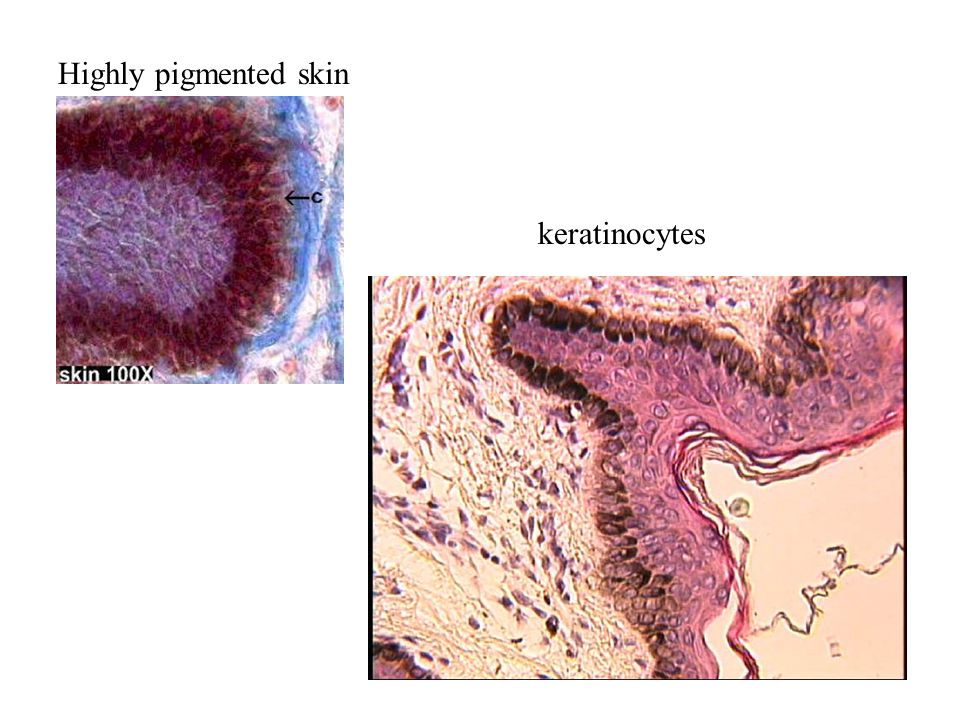 Highly pigmented skin keratinocytes