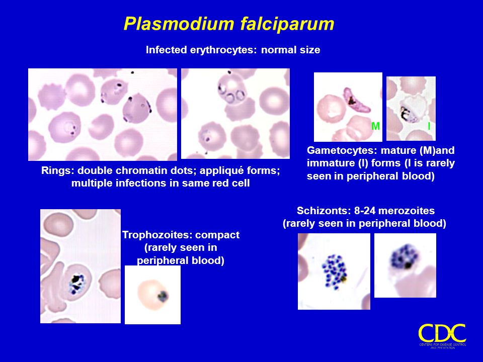 Тяжелое течение малярии ассоциируется чаще. Plasmodium falciparum гаметоцит. Малярия шизонт. Плазмодий фальципарум строение. Плазмодиум малярия строение.