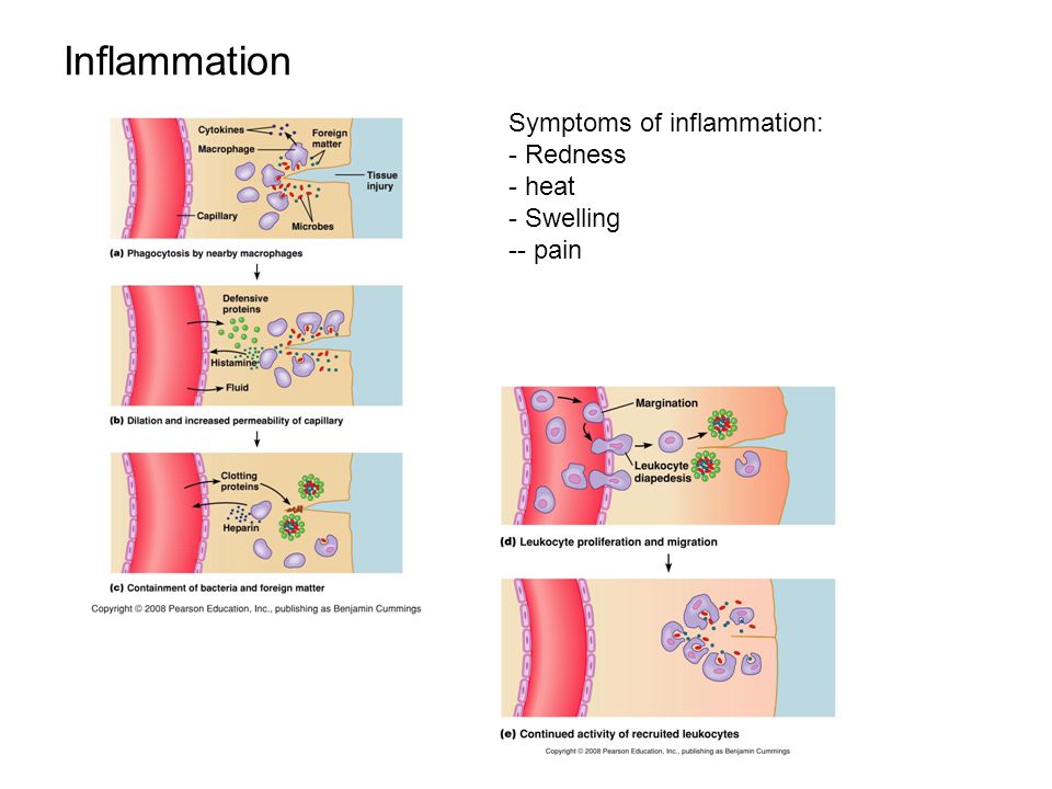 Inflammation Symptoms of inflammation: Redness heat Swelling - pain