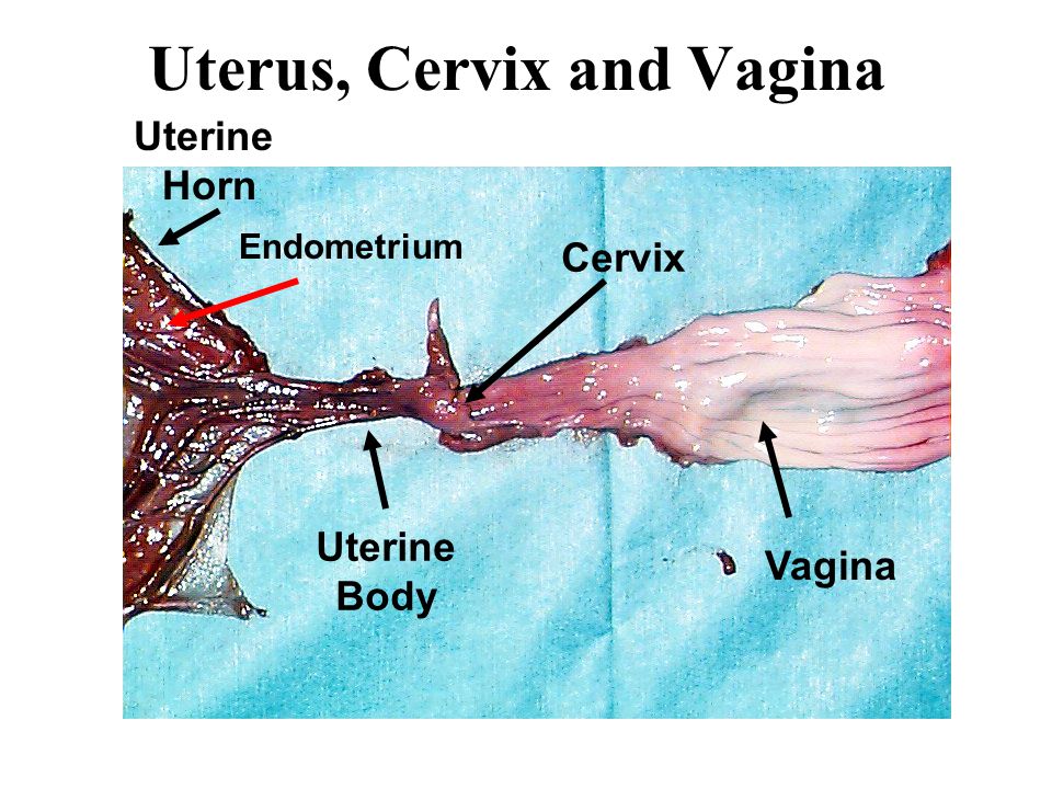 Uterus, Cervix and Vagina.