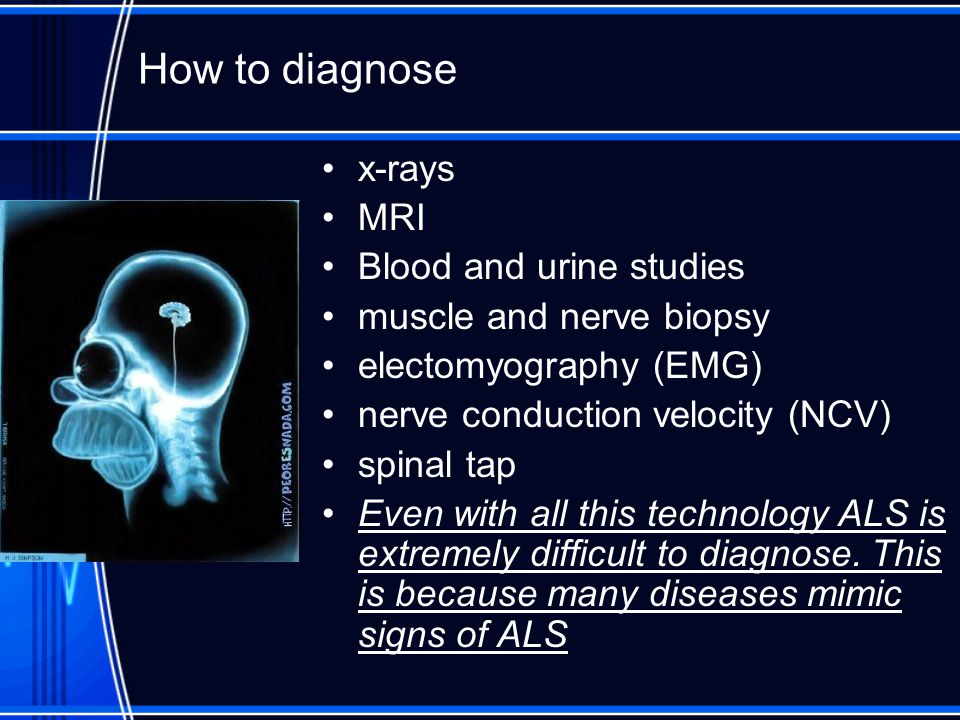 How to diagnose x-rays MRI Blood and urine studies