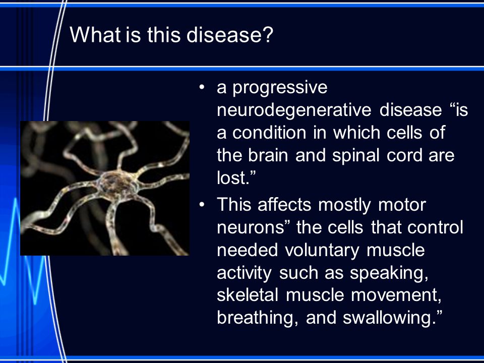 What is this disease a progressive neurodegenerative disease is a condition in which cells of the brain and spinal cord are lost.