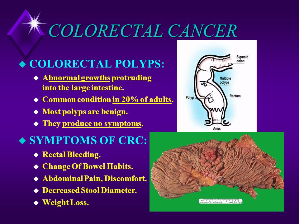 COLORECTAL CANCER COLORECTAL POLYPS: SYMPTOMS OF CRC: