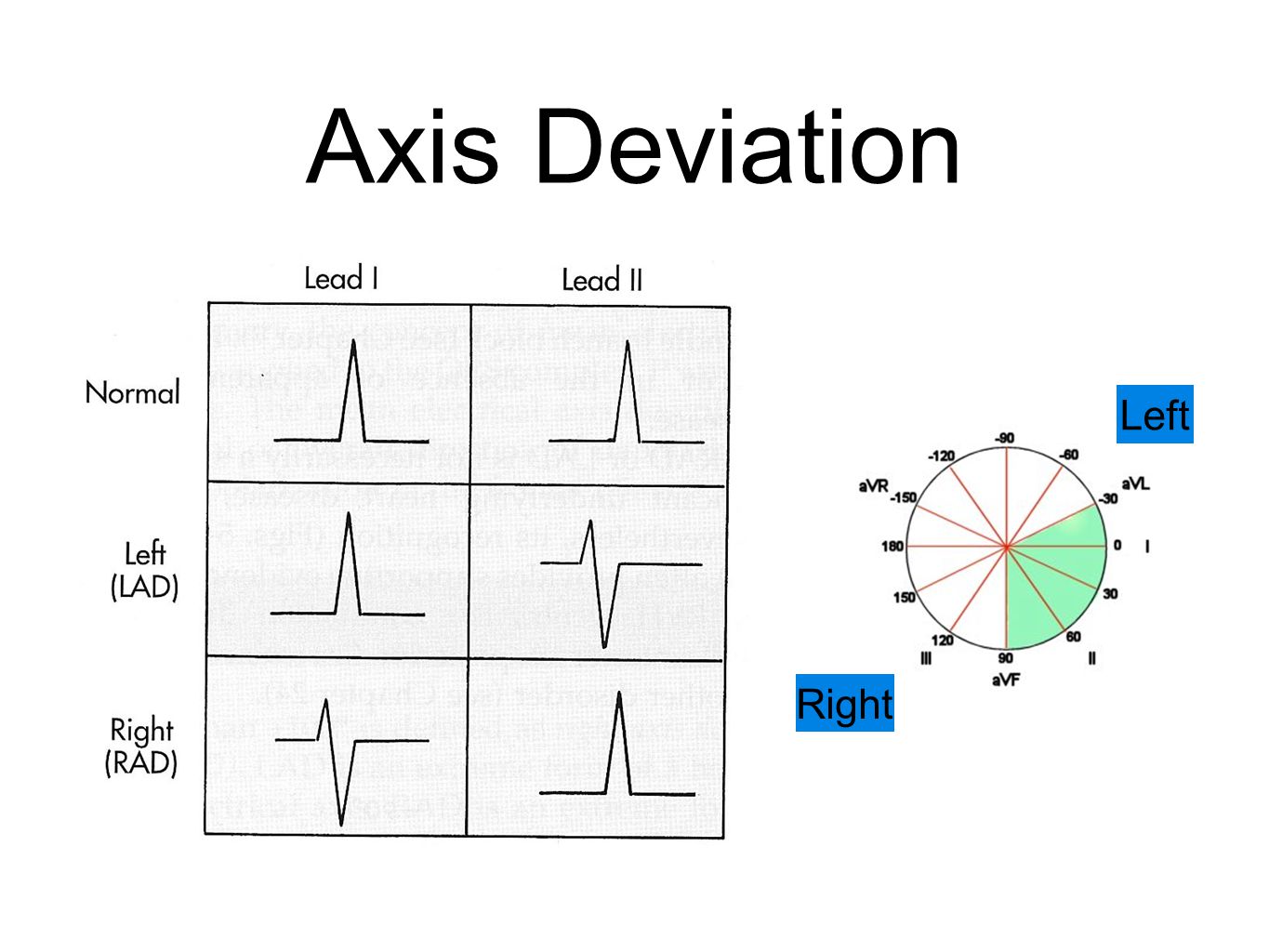 Deviation перевод. Axis deviation. Right Axis deviation. Left Axis deviation. ECG Axis.