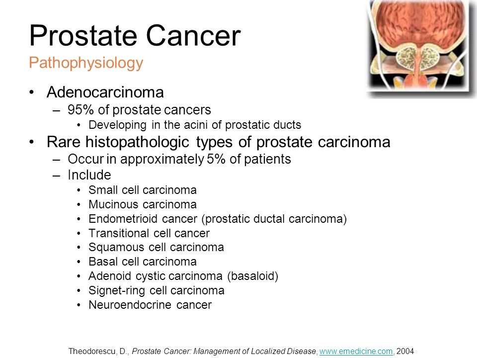 emedicine prostate cancer