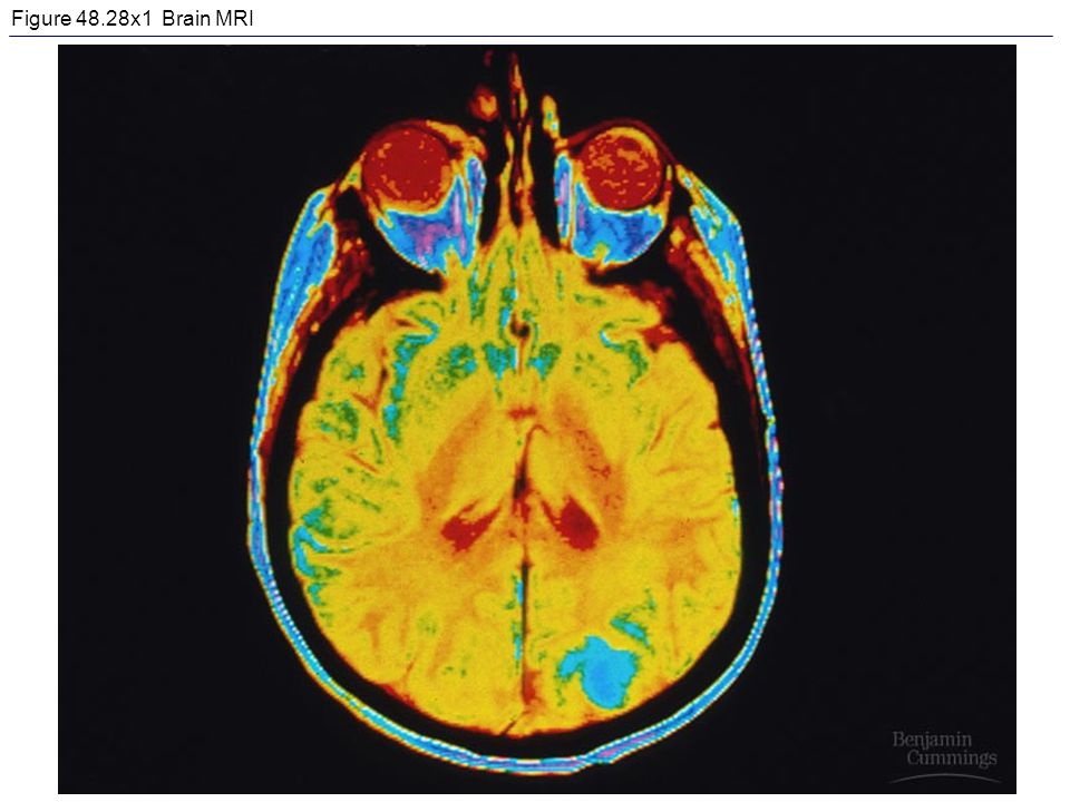 Figure 48.28x1 Brain MRI