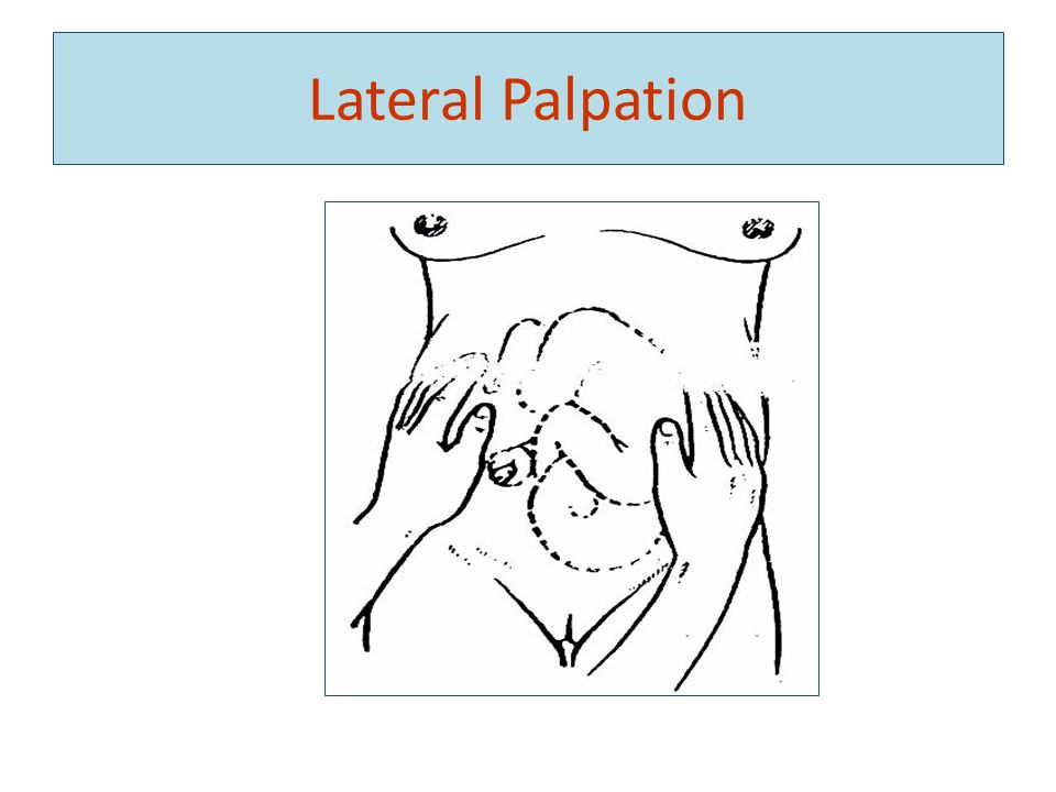 Lateral Palpation