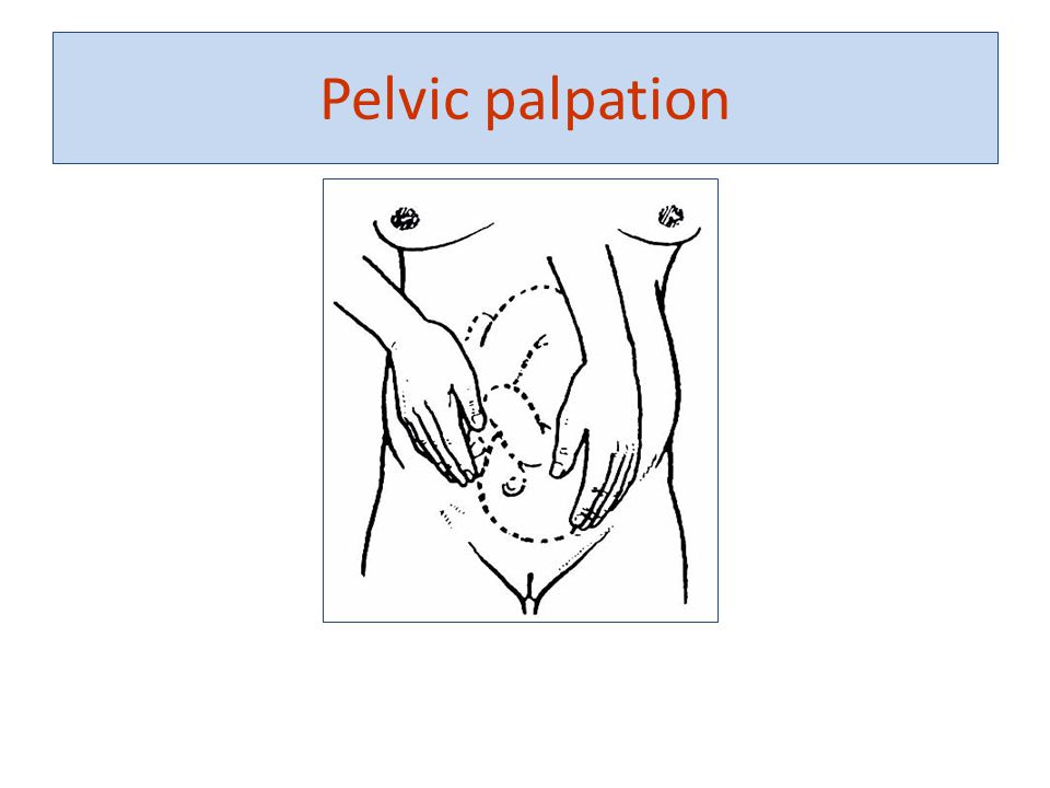 Pelvic palpation