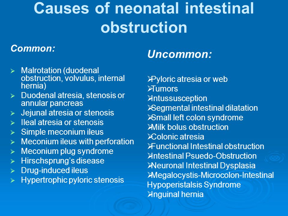 Résultat de recherche d'images pour "Neonatal Intestinal Obstruction"