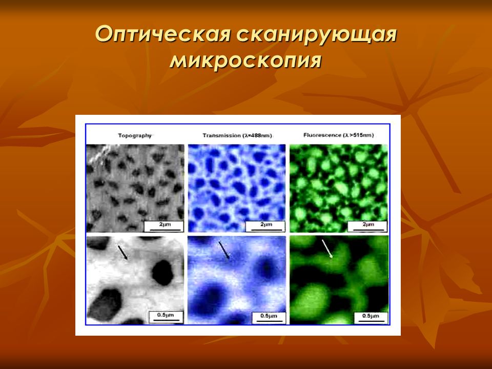 Оптическая микроскопия. Методы оптической микроскопии. Оптическая микроскопия кратко. Оптическая микроскопия физика.