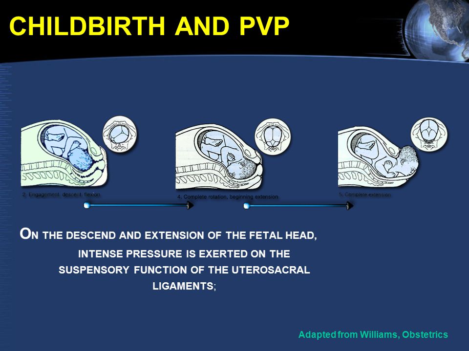 CHILDBIRTH AND PVP