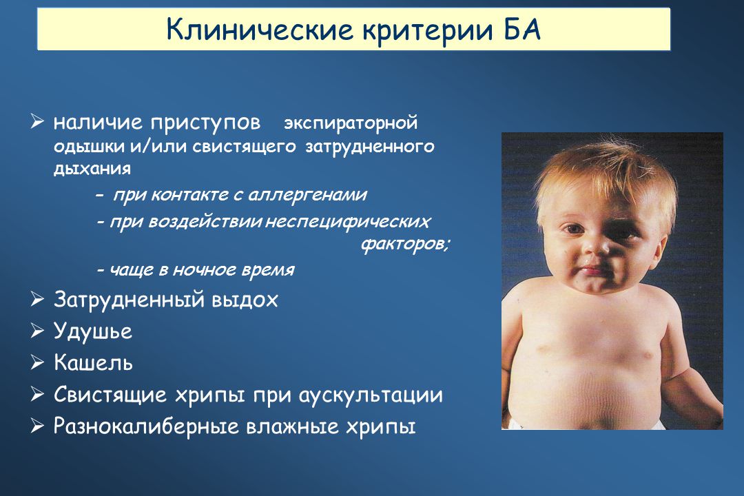 У ребенка 8 лет влажный. Хрипы при дыхании у ребенка. Одышка у ребенка как определить. Хрипы при дыхании у ребенка б. Хрипы у новорожденного при дыхании.